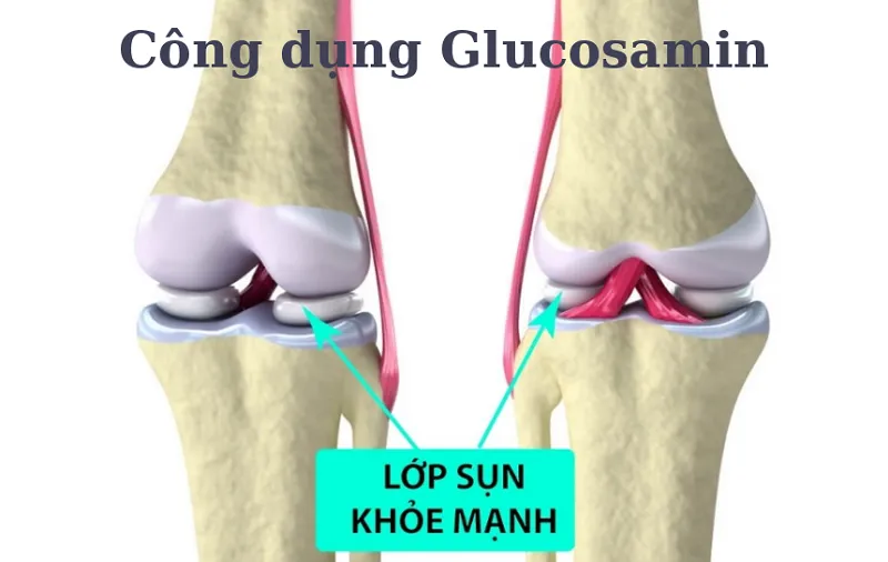 Glucosamine được nghiên cứu rộng rãi và được nhiều chuyên gia y tế đánh giá cao