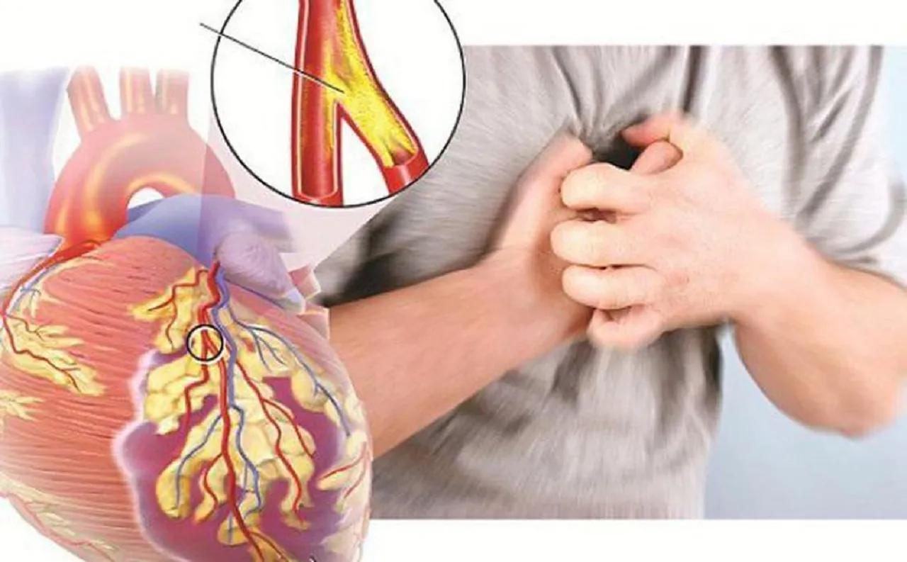 Coenzyme Q10 đóng vai trò quan trọng trong việc ngăn ngừa xơ vữa động mạch