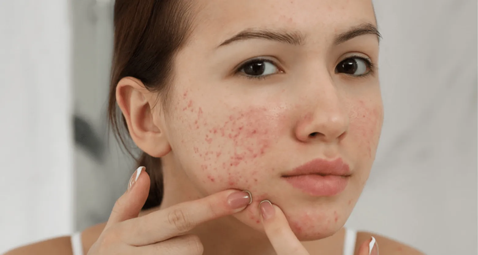 Hỗ trợ giảm các triệu chứng liên quan đến viêm